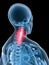 X-ray anatomy-neck inflammation