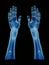 X-ray of arm of a male human, blue tone radiograph on a black background, Xray Orthopedic Medical, Ai generative