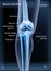 X ray bones the of knee