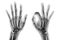 X-ray both hands with OK sign