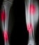 X-ray of both human legs