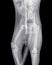 X-ray of a cat with a femur fracture