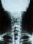 X-ray of a cervical spine(neck)