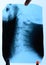 X-ray of the cervical vertebrae. X ray image of the cervical spine