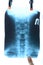 X-ray of the cervical vertebrae. X ray image of the cervical spine