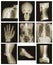 X-ray collection