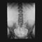 X-ray film of of the abdominal cavity and pelvic organs. Radiograph film of people