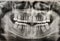 X ray film of human mouth with healthy teeth. Detail of panoramic facial x-ray image