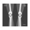 X-ray Film of Leg Joints Vector Illustrated Image for Educational Purpose