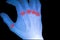 X-ray film show normal human\'s hand right.