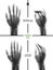 X-ray of the hand. Fracture of the 5rd metacarpal bone. Reposition. Osteosynthesis. Marker. Negative.