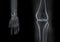X-ray hand and knee bones
