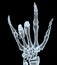 X-ray hand making offensive gesture