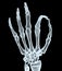 X-ray hand making ok gesture