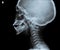 X ray of head showing part of neck.