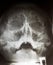 X-ray of the head together with the jaw