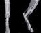 X ray of the  hind leg of a cat with a fracture of the shinbone tibia