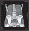 X-ray of human abdomen with pelvic bone and spine