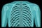 X-ray of the human chest, the concept of preventive examination, treatment of injuries, lung diseases