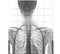 X-ray of human chest and spinal column, front view