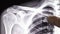 X ray of human shoulder detail.mov