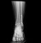 X-ray image Ankle foot joint