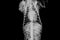 X-ray image of a dog in a vet clinic, veterinary concept