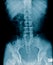 X-ray image of human abdomen, picture of human spine