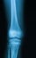 X-ray image of knee joint.