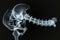 This x-ray image provides a detailed view of a human skeleton, showcasing the various bones, joints, and the spine, X-ray film of