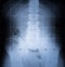 X Ray image of Spine and pelvis of human body