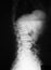 X-ray image of T-L spine, lateral view.