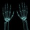 X-ray left and right hands