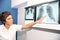 X-ray of lung, pulmonary embolismPE, pulmonary hypertension, C