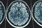 X-Ray or MRI brain scan background, magnetic resonance tomography image