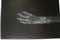X-ray picture of carpal bones by retriever