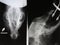 X-ray picture of osteolysis and shot (scull of dog)