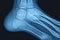 X-ray. X-ray of head, foot, head, mouth, ribs and hands. Bone scan. Body injury. X-ray analysis of human teeth.