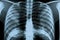 X-ray. X-ray of head, foot, head, mouth, ribs and hands. Bone scan. Body injury. X-ray analysis of human teeth.