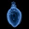 X-ray robotic heart