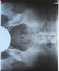 X-ray of the and sacrum. X-ray