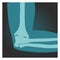 X-ray shot of elbow side view, human body, bones of hand, radiography, vector illustration.