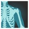 X-ray shot of shoulder, human body bones, radiography, rib cage, chest and arm, vector illustration.