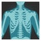 X-ray shot of shoulder, human body bones, radiography, rib cage, chest and arm, vector illustration.