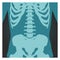 X-ray shot of spinal column, pelvis and rib cage, human body bones, radiography, vector illustration.