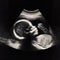 x ray Ultrasound baby image. ai generative