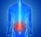 X-ray view of Spine pain - vertebrae trauma