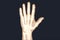 X-rayed human hand.