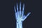 X-rayed human hand.