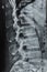 X-rays of the spine